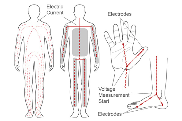 Bioelectrical Impedance Analysis (BIA)